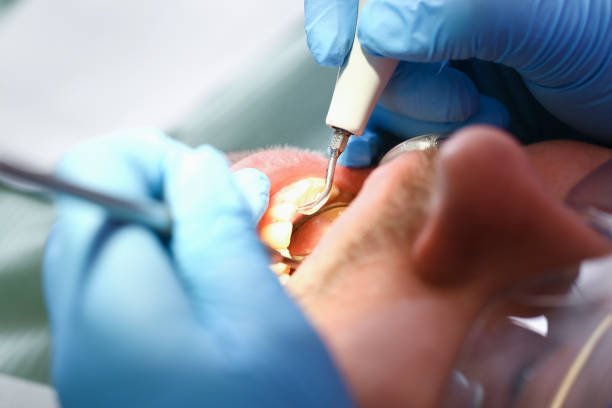 Best Emergency Denture Repair in Kings Mountain, NC