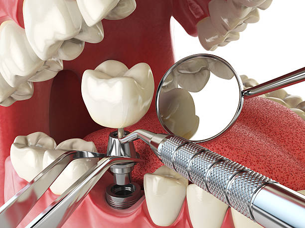 Professional Emergency Dental Service in NC